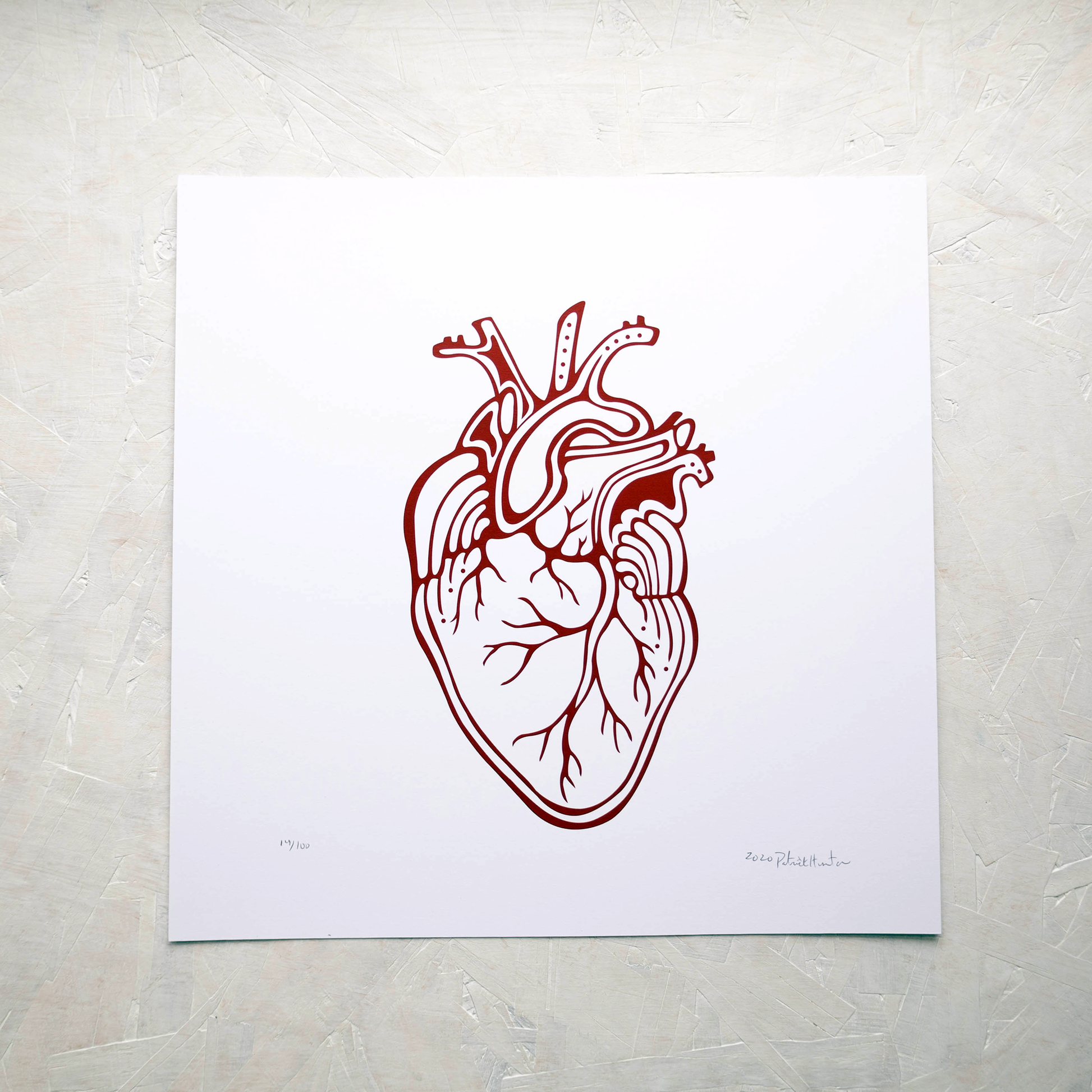 Print of Patrick Hunter's painting of an anatomical heart in red and white, woodland art style.