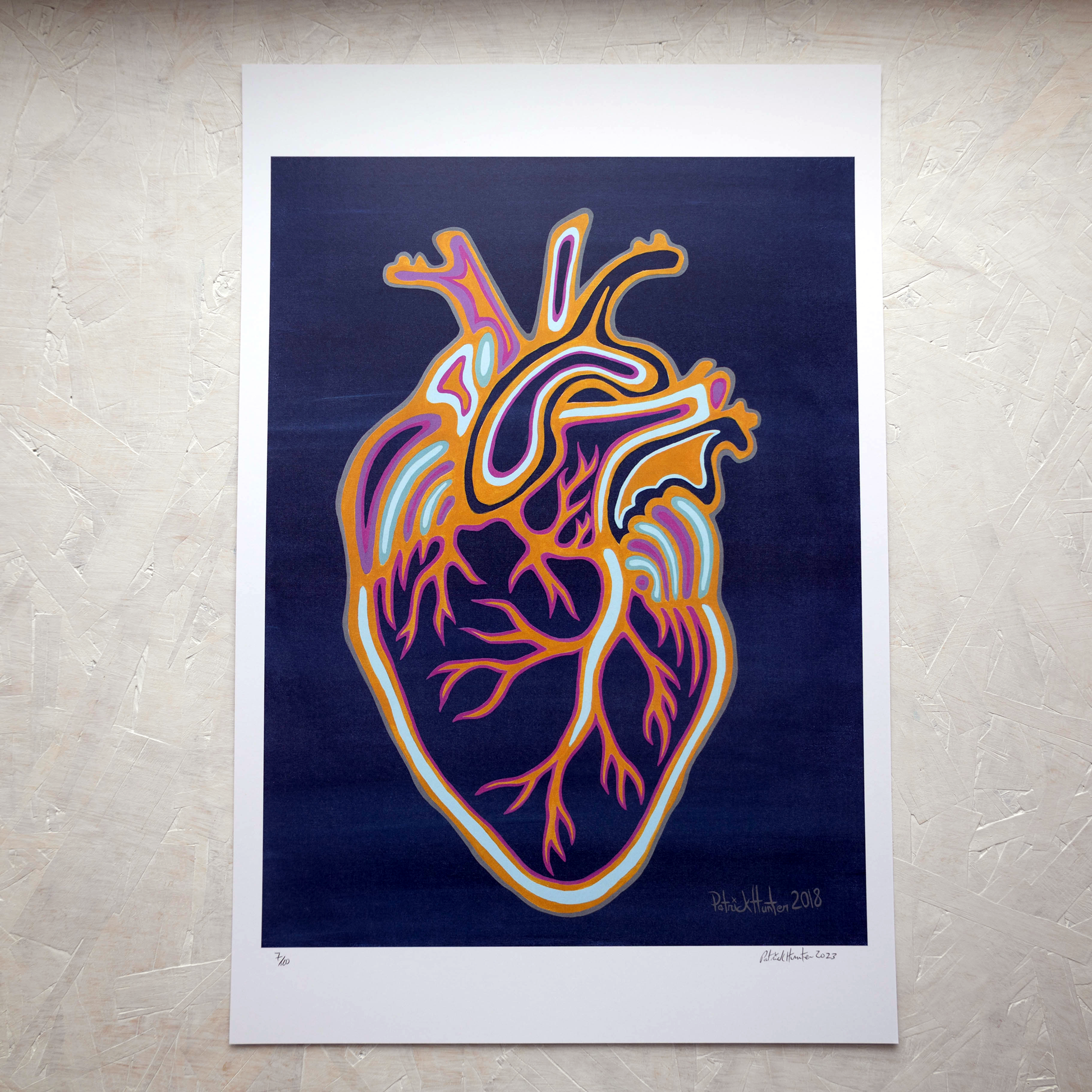 Print of Patrick Hunter's painting of an anatomical heart on dark blue background, woodland art style.
