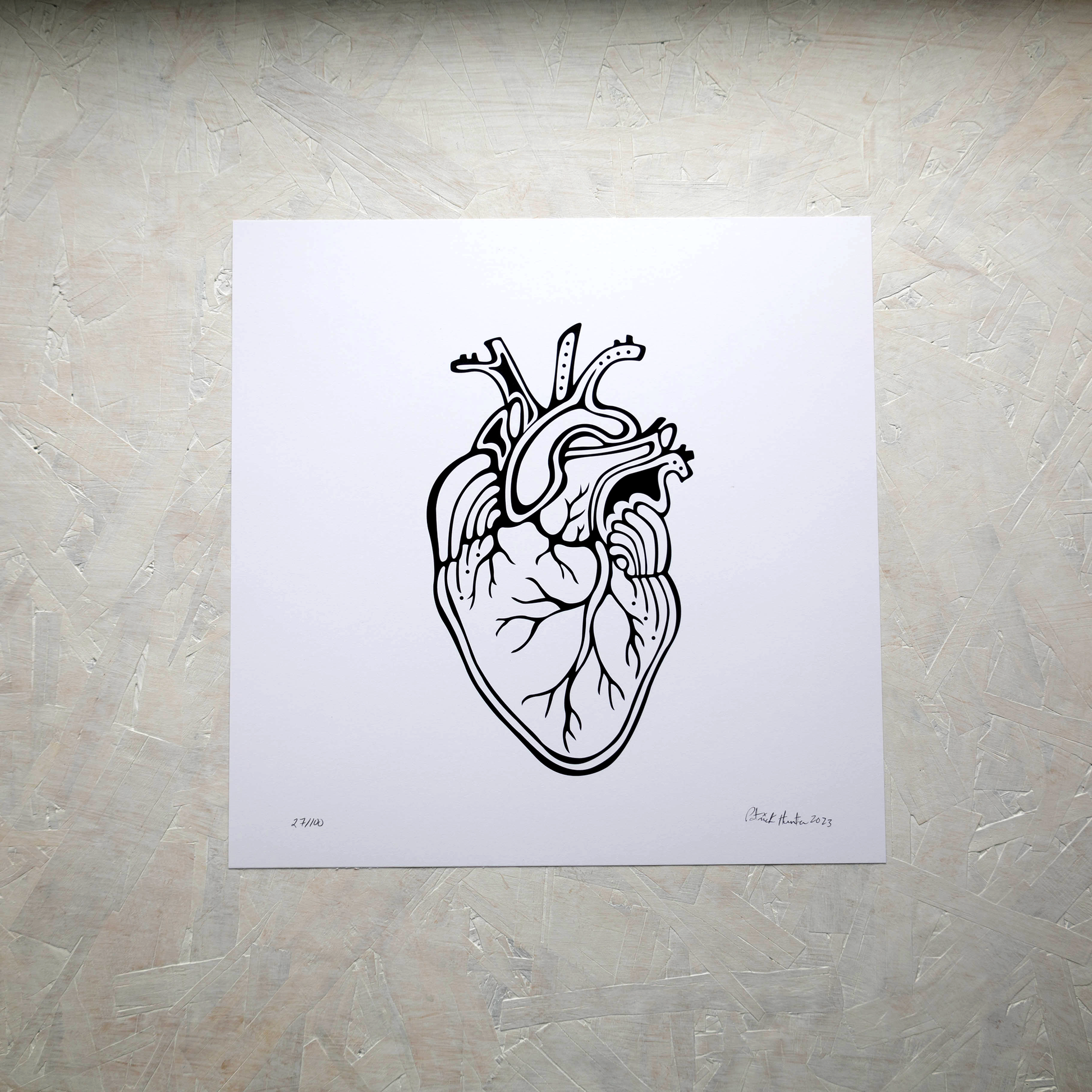 Print of Patrick Hunter's painting of an anatomical heart in black and white, woodland art style.